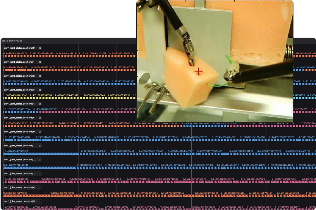 Foxglove visualization of health robotics data